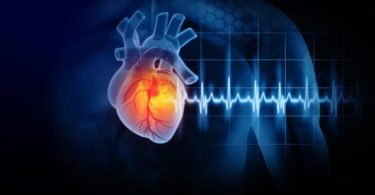 Difference Between Ischemic Heart Disease and Myocardial Infarction